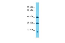 USP12 Rabbit anti-Mouse, Polyclonal, Novus Biologicals 0.1ml; Unconjugated:Antibodies,